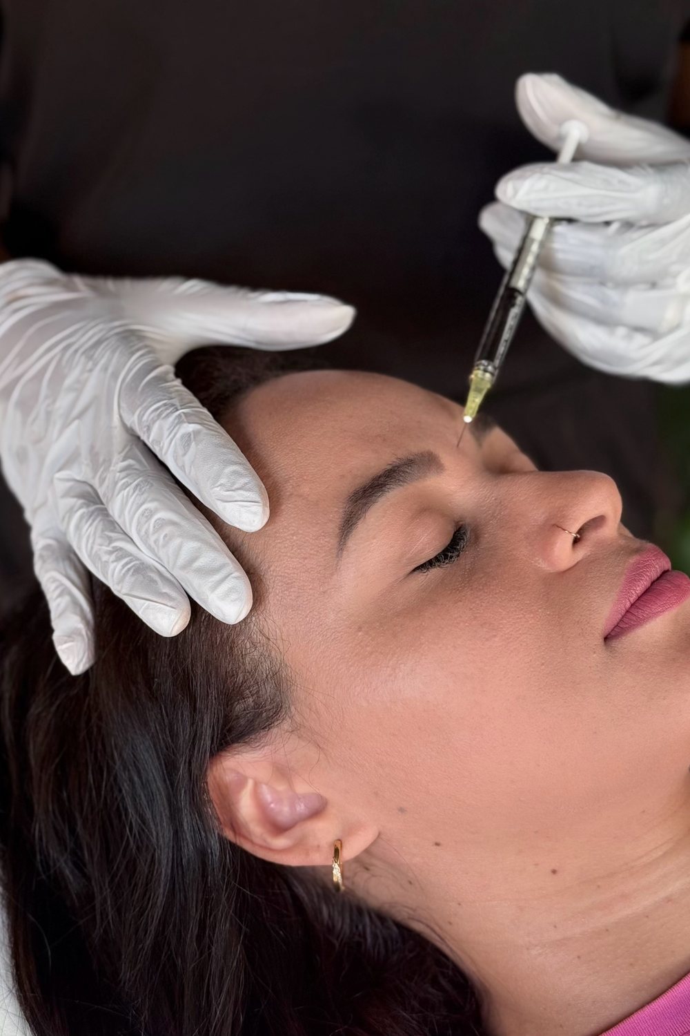 Doctor-led anti-wrinkle treatment at Lumina Aesthetics, Limerick