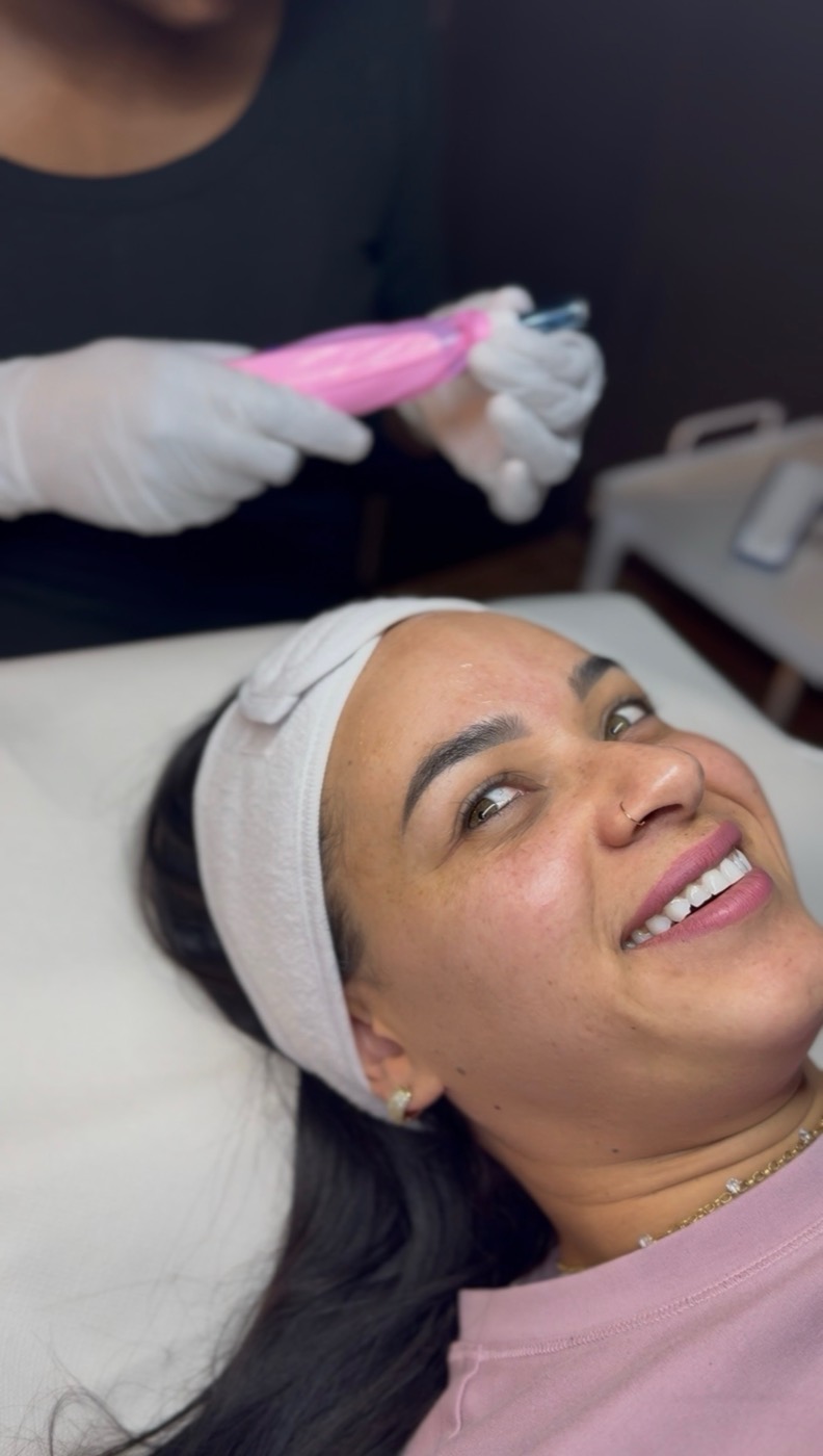 A relaxed patient during a microneedling session at Lumina Aesthetics