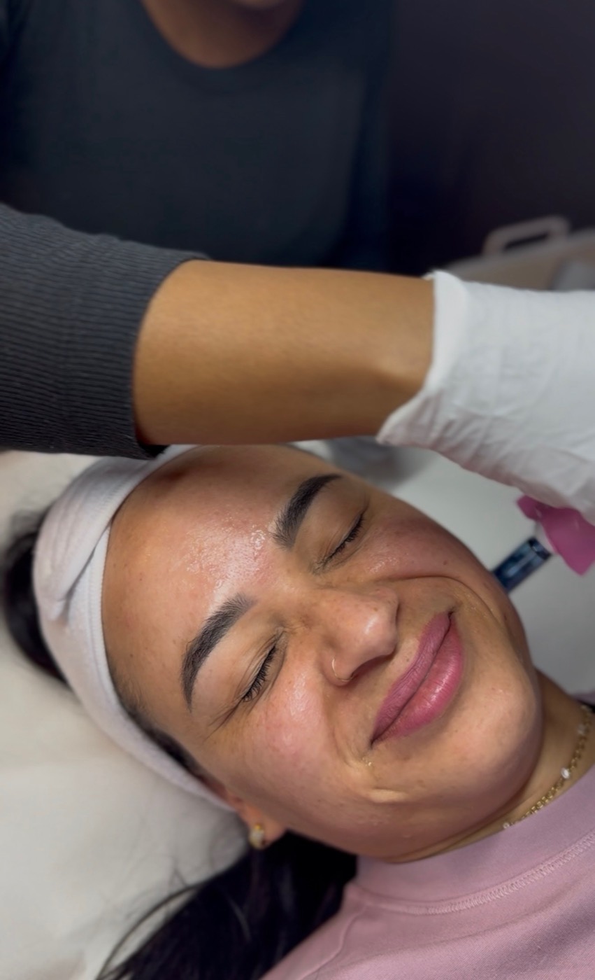 Healthy, glowing skin supported by microneedling